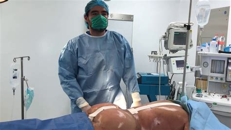 Trained internationally, including in the United States and Europe. . Best brazilian buttock lift surgeon in mexico